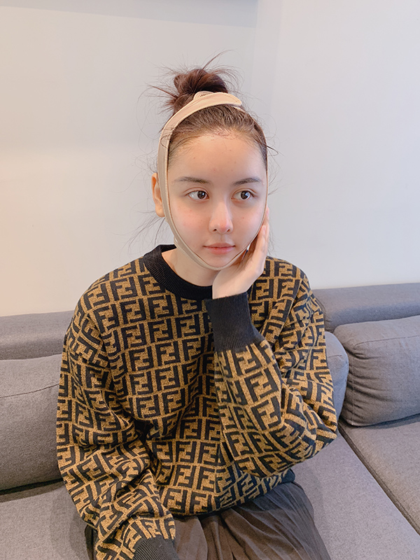 Không còn giấu diếm nữa, Hà Lade giờ đây đã tự tin công khai đăng ảnh sang Hàn Quốc thẩm mỹ rồi!