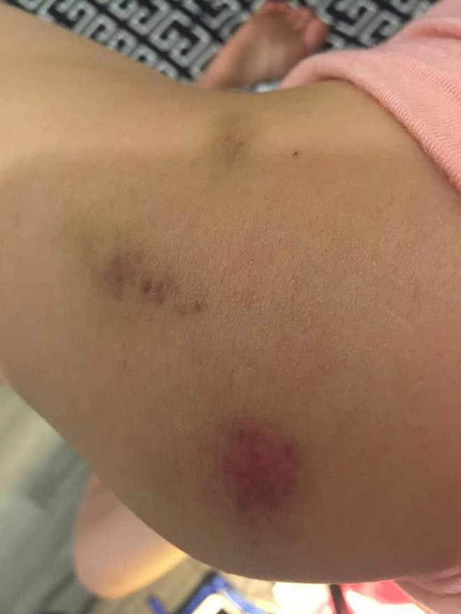 Hai vợ chồng chủ căn hộ 5 sao ở Hà Nội tố bị trưởng ban quản trị tòa nhà hành hung nhập viện