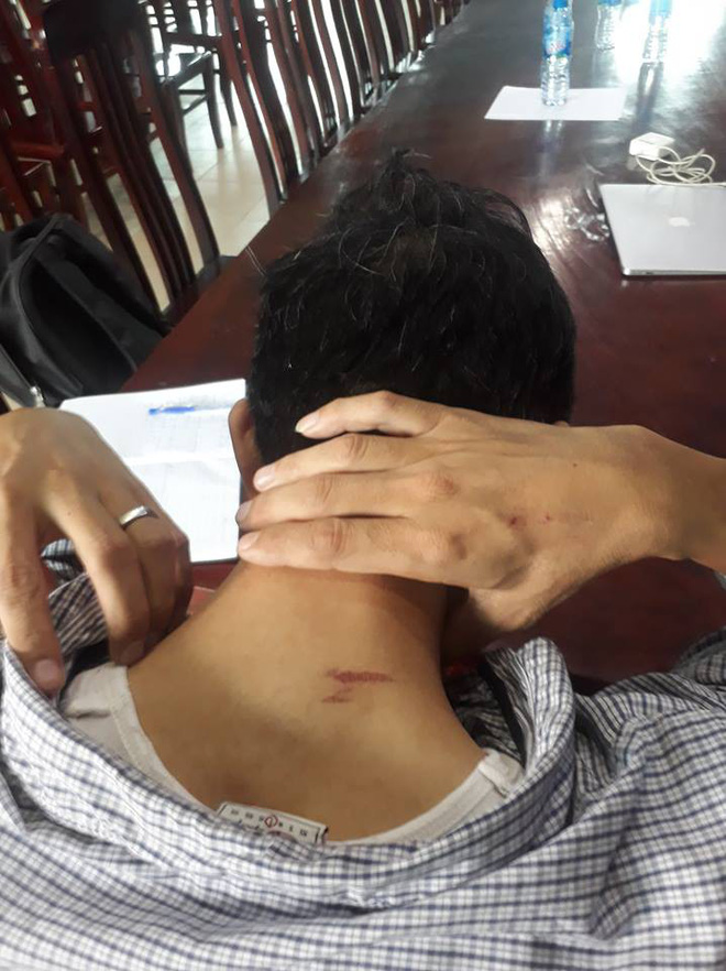 Hai vợ chồng chủ căn hộ 5 sao ở Hà Nội tố bị trưởng ban quản trị tòa nhà hành hung nhập viện