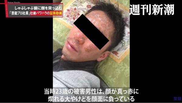 Sếp nhấn đầu nhân viên vào nồi lẩu đang sôi, những người xung quanh không phản đối mà còn reo hò