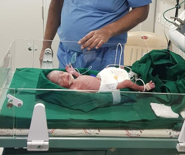 Bé gái châu Á đầu tiên ra đời nhờ cấy ghép tử cung của bà ngoại