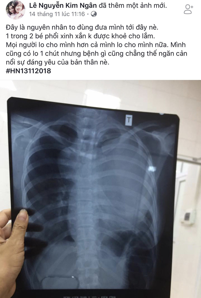 Cô gái 22 tuổi bị u phổi: Bệnh tật không có gì đáng sợ cả, sợ nhất nước mắt bố mẹ thôi