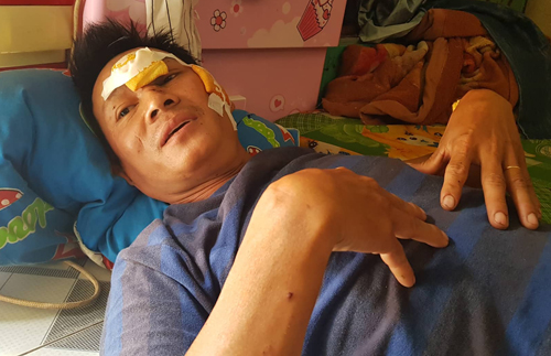 Nạn nhân cháy xe bồn ở Bình Phước đập tường, kêu cứu qua cửa thông gió