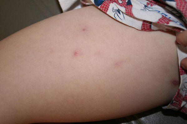 Xuất hiện những dấu hiệu này cho thấy bạn đang bị stress nghiêm trọng, cần khắc phục ngay bằng một chế độ ăn lành mạnh