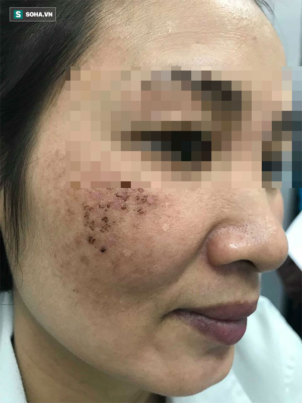 Chi cả trăm triệu làm đẹp mặt vẫn biến dạng, nhiều quý bà phải cầu cứu bác sĩ