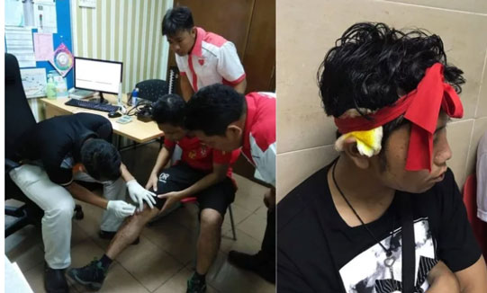 Sốc: CĐV Myanmar bị cướp, đánh dã man, cảnh sát Malaysia thờ ơ