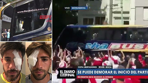 CĐV bạo động, tấn công cầu thủ Boca, Superclasico lại hoãn