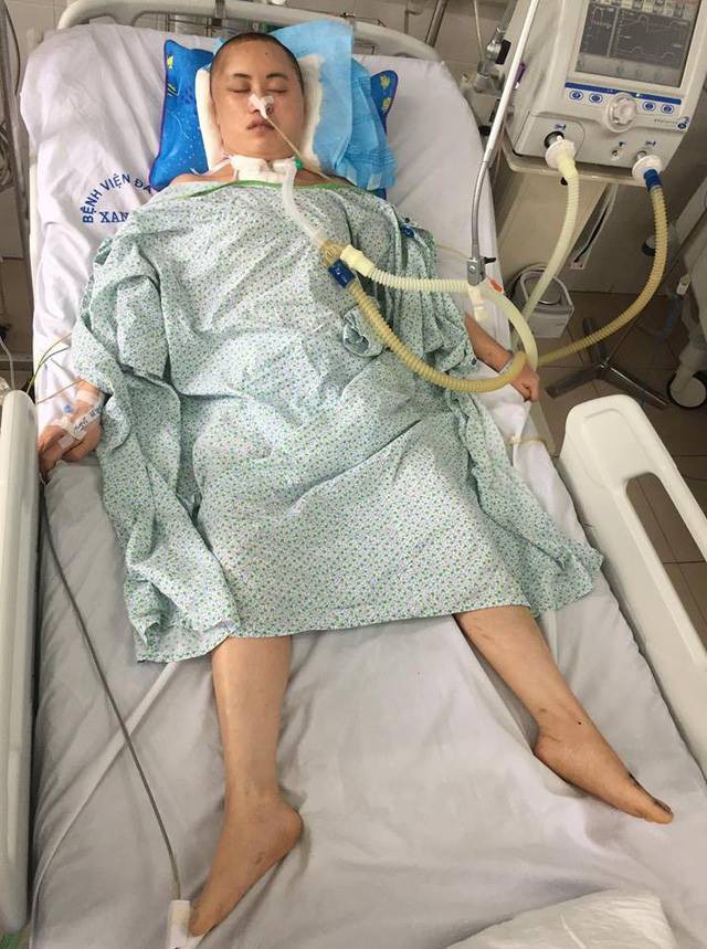 Hà Nội: Cô gái trẻ bị chấn thương sọ não sau tai nạn giao thông, nằm cả tháng ở viện không có người thân đến nhận