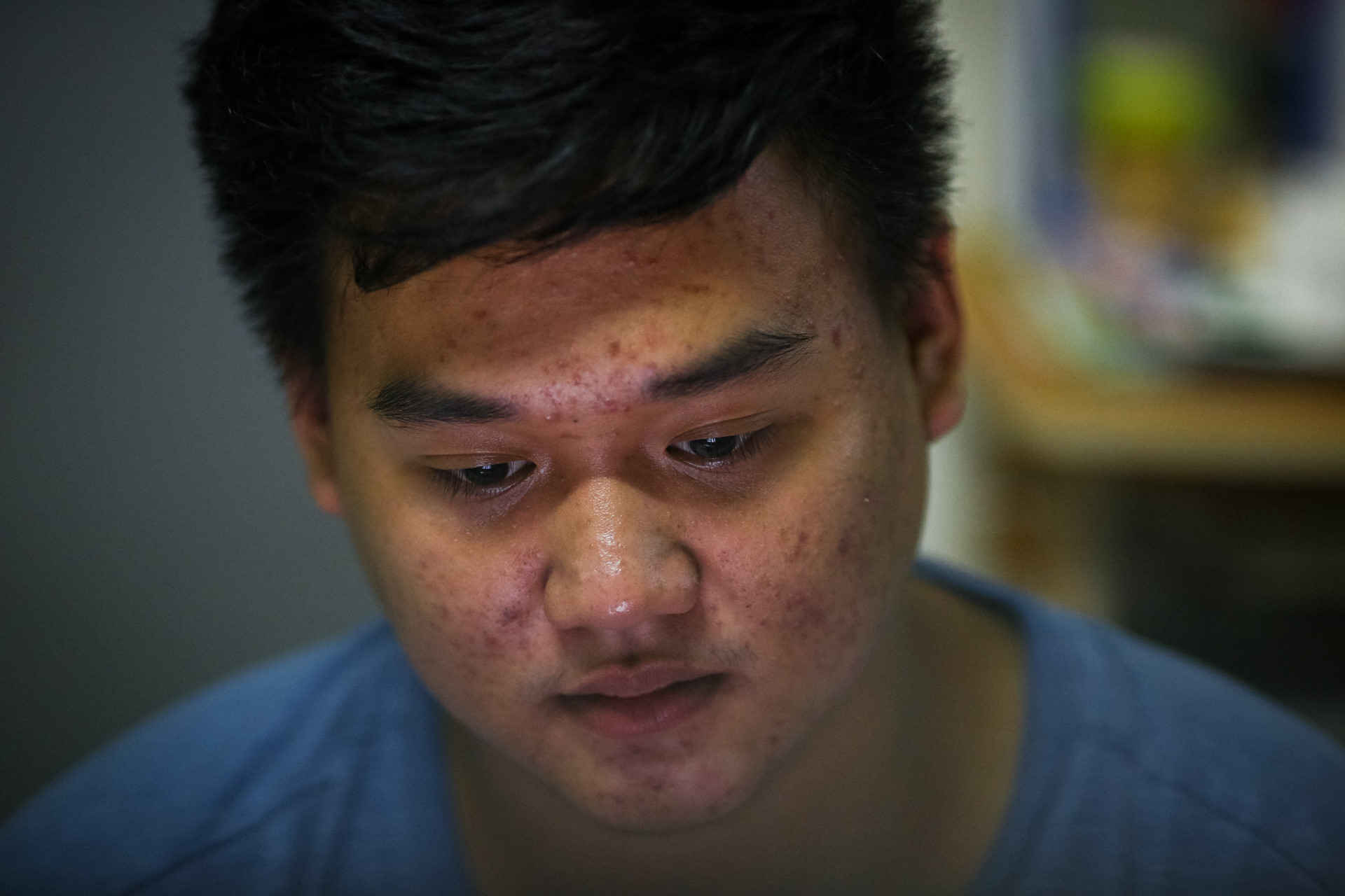 Chàng trai 9 lần lên bàn mổ sau tai nạn giao thông