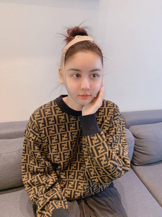 Sau nửa tháng phẫu thuật thẩm mỹ, Hà Lade bất ngờ lên tiếng khi bị chê đơ cứng, khuôn mặt đại trà