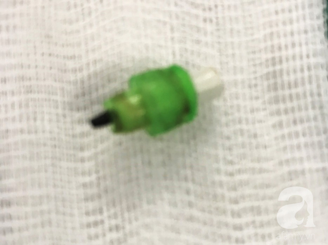 Cắn bút khi ngồi trong lớp, bé gái 7 tuổi ở TP.HCM suýt chết vì nuốt ruột bút chì vào phổi