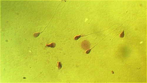 Đại học Harvard sẽ chỉnh sửa gene tinh trùng