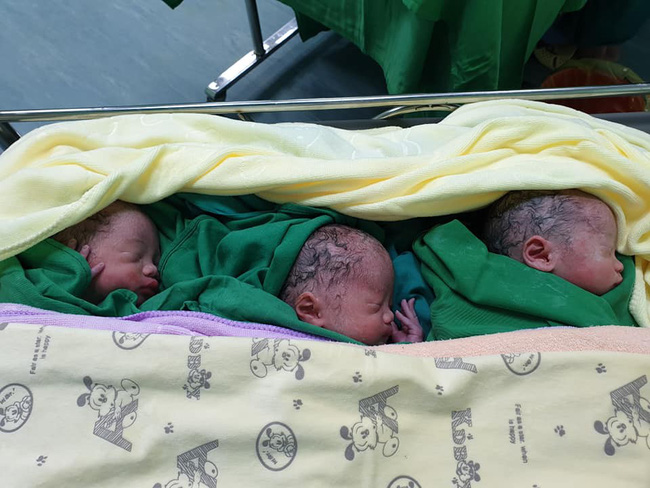 Cả thai kỳ mẹ Việt đi siêu âm thai đôi, đến khi mổ lấy ra 2 bé, bác sĩ phát hiện: Ôi trời đất ơi, còn 1 bé nữa!