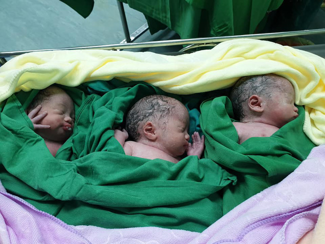 Cả thai kỳ mẹ Việt đi siêu âm thai đôi, đến khi mổ lấy ra 2 bé, bác sĩ phát hiện: Ôi trời đất ơi, còn 1 bé nữa!