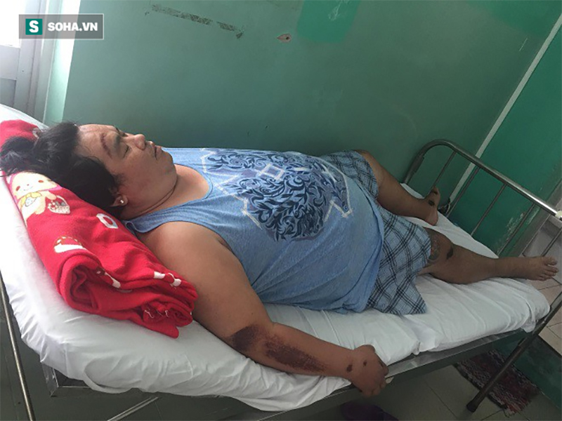 Trước khi gặp tai nạn nghiêm trọng, Hoàng Mập nhiều lần nằm mơ điều đáng sợ