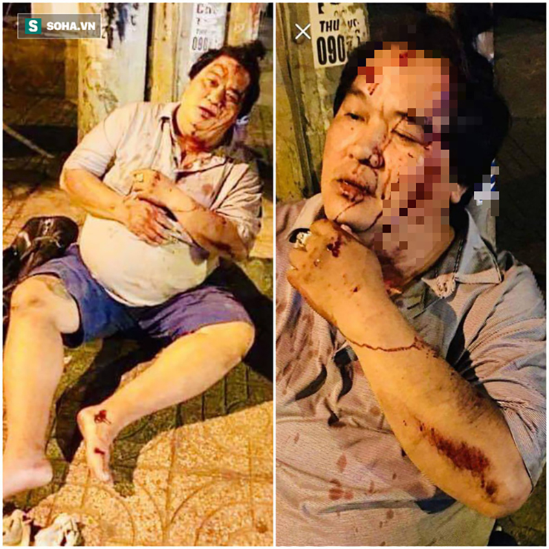 Trước khi gặp tai nạn nghiêm trọng, Hoàng Mập nhiều lần nằm mơ điều đáng sợ