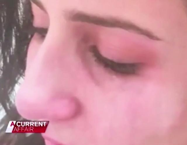 Sợ chồng bỏ, vợ tự tát mình sưng tím mặt mày để vu oan tội bạo hành