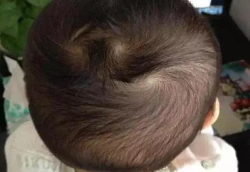 Đứa trẻ có xoáy tóc này, vừa sinh ra đã tài giỏi hơn người, lớn lên sẽ thành đạt giàu có Đứa trẻ có xoáy tóc này, vừa sinh ra đã tài giỏi hơn người, lớn lên sẽ thành đạt giàu có