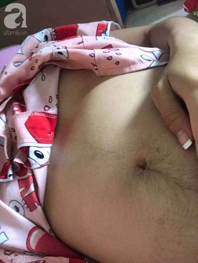 Bệnh viện Từ Dũ công bố nguyên nhân vụ thai phụ 24 tuổi bị mất con sắp sinh: Do đột tử