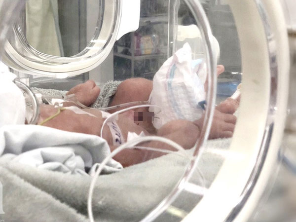Bé gái 4kg ngạt thở, liệt cánh tay phải ở Bình Thuận: Do rủi ro trong cuộc sinh