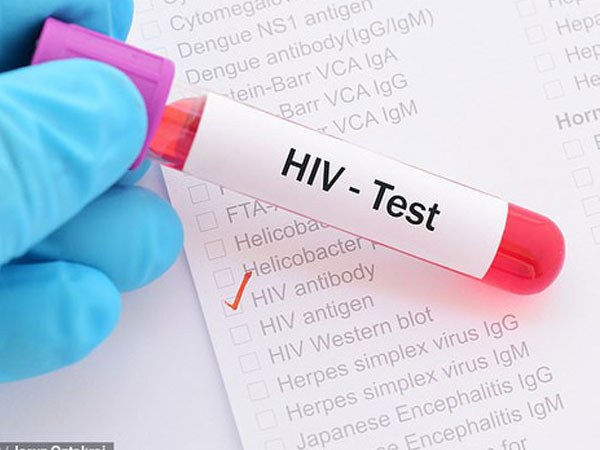 Phát hiện cơ chế giúp chữa khỏi HIV ngay trong não người