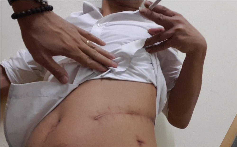 Điều tra: Giao ước ngầm trong trại nuôi người lấy thận ở Hà Nội