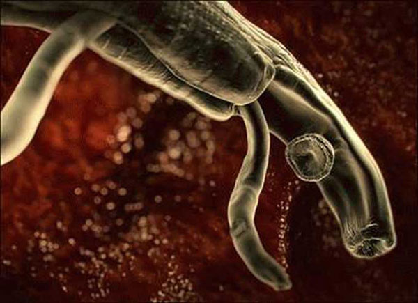 Người phụ nữ tử vong do bị amip ăn não người tấn công sau khi dùng bình rửa mũi