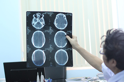 Cái chết bất thường sau tiêm ngừa uốn ván của nữ bệnh nhân