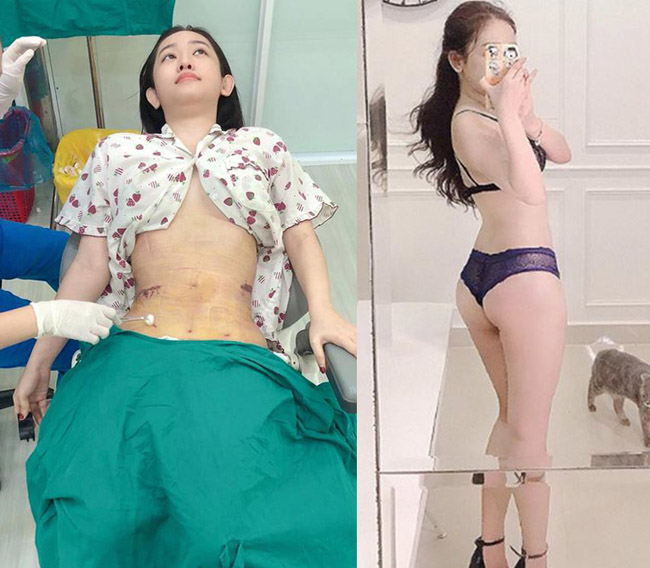 Đã đẹp sẵn rồi, Huyền Baby, Thúy Vi, Nhã Phương... vẫn sửa mặt