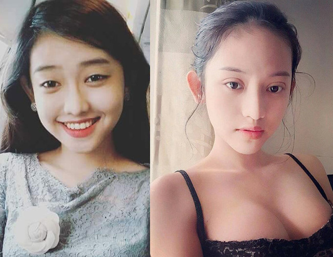 Đã đẹp sẵn rồi, Huyền Baby, Thúy Vi, Nhã Phương... vẫn sửa mặt