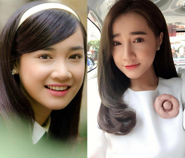 Đã đẹp sẵn rồi, Huyền Baby, Thúy Vi, Nhã Phương... vẫn sửa mặt