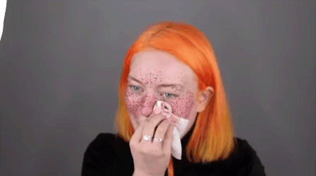 Nghịch dại tự xăm tàn nhang giả bằng mực henna, cô nàng này nhận quả đắng nhưng lại nổi như cồn trên Internet