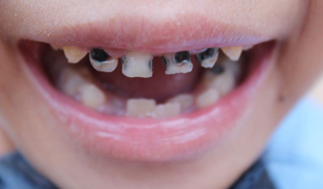 3 thói quen ăn uống hằng ngày âm thầm lấy đi sự thông minh của con trẻ mà nhiều bố mẹ vô tình bỏ qua