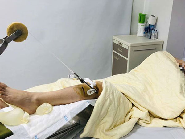 Trích xuất camera truy tìm xe Range Rover đâm nữ sinh rồi bỏ trốn