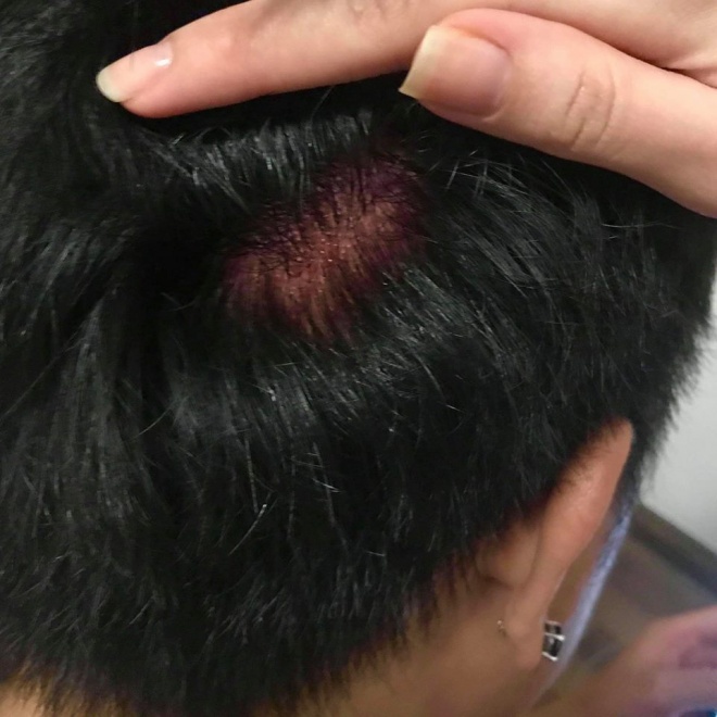 Cũng đi bão ăn mừng chiến thắng của đội tuyển Việt Nam như ai, bạn thân Trấn Thành lại dính chấn thương từ trên trời rơi xuống