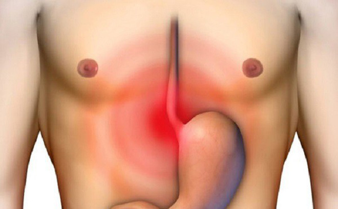 Đau vị trí này cảnh báo ung thư dạ dày cần đi kiểm tra ngay