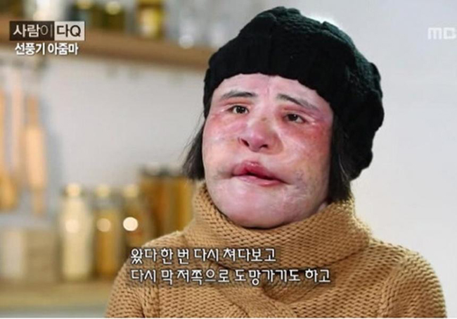 Cuộc đời đau khổ vì cuồng phẫu thuật thẩm mỹ của Han Mi Ok