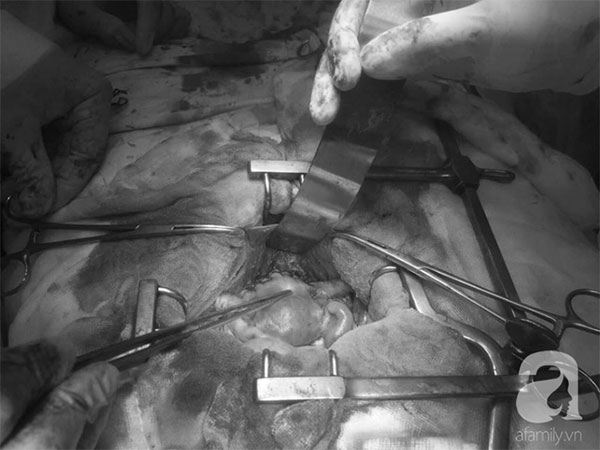 Lại thêm bệnh nhân ung thư tử cung dù còn rất trẻ: Điểm mặt những ca ung thư phụ khoa ám ảnh trong năm 2018