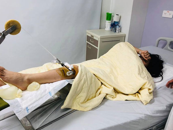 Đã bắt được tài xế Range Rover đâm nữ sinh bất tỉnh rồi bỏ trốn