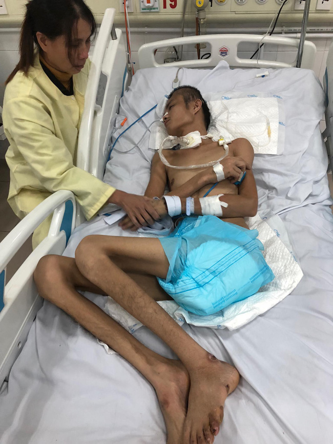 Đường cùng của người vợ ôm con khắp nơi xin tiền lo cứu chữa cho chồng bị chấn thương sọ não sau vụ tai nạn giao thông