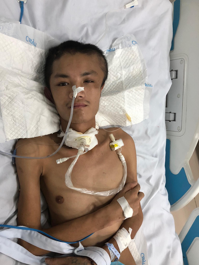 Đường cùng của người vợ ôm con khắp nơi xin tiền lo cứu chữa cho chồng bị chấn thương sọ não sau vụ tai nạn giao thông