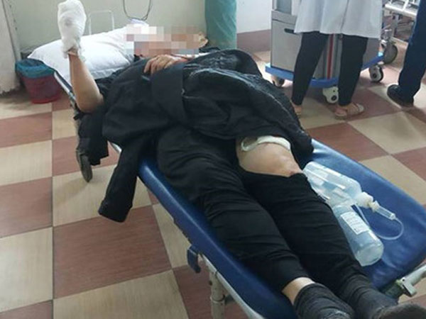 Tài xế xe ôm chém đứt lìa tay chủ quán ăn