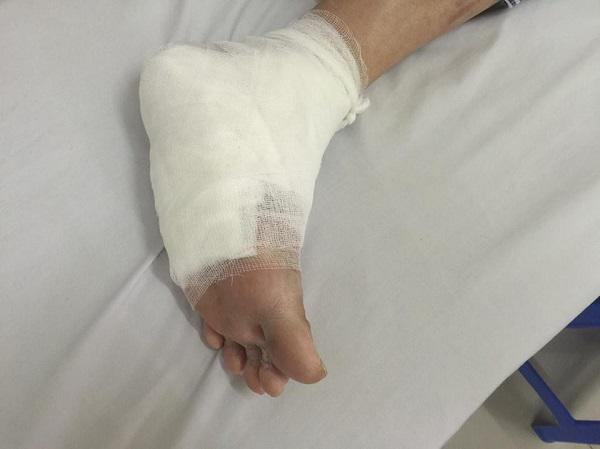 Căn bệnh gây biến chứng khiến NSND Anh Tú qua đời ở tuổi 56 nguy hiểm thế nào?