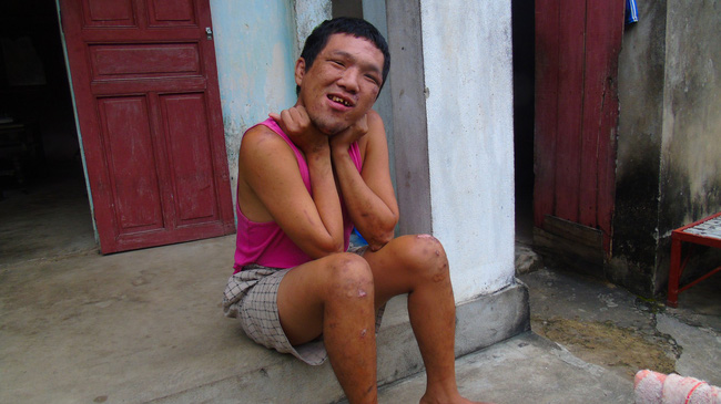 Gánh nặng của cụ ông 64 tuổi một mình chăm con tâm thần, vợ tai biến: Nếu tôi chết, vợ con sẽ sống thế nào đây?