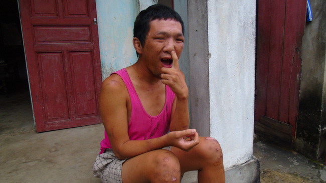 Gánh nặng của cụ ông 64 tuổi một mình chăm con tâm thần, vợ tai biến: Nếu tôi chết, vợ con sẽ sống thế nào đây?