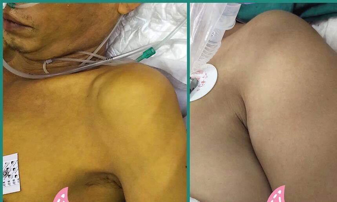 BS Bệnh viện Việt Đức cảnh báo: Đang uống thuốc Tây, bạn uống thêm thứ này thành... tự sát