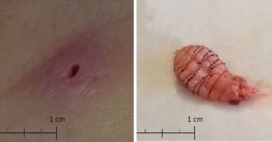 7 ca bệnh gây chấn động nhất năm 2018 nghe chừng tưởng như chỉ có trong phim kinh dị