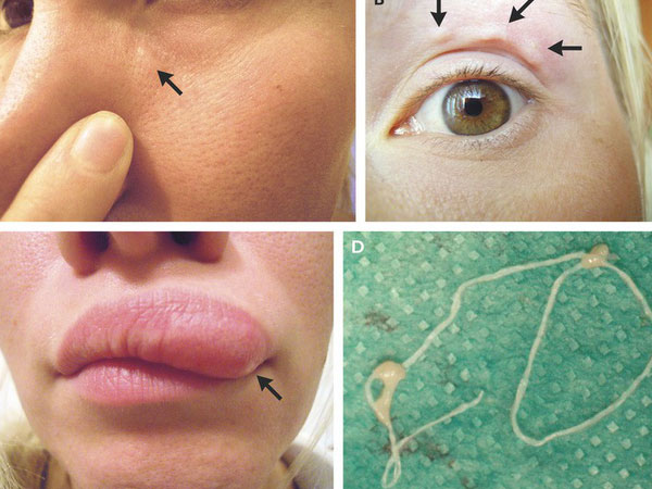 7 ca bệnh gây chấn động nhất năm 2018 nghe chừng tưởng như chỉ có trong phim kinh dị