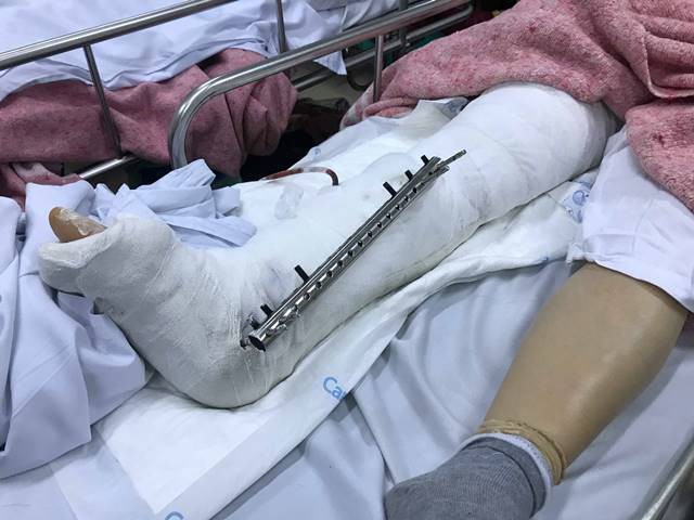 Nạn nhân vụ nữ tài xế xe Lexus gây tai nạn liên hoàn ở HN chưa nhận được lời xin lỗi