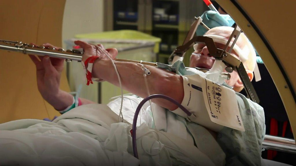 Mổ phanh não khi bệnh nhân vẫn đang tỉnh? Phương pháp nghe thì ghê rợn này ngày càng phổ biến và đây là lý do